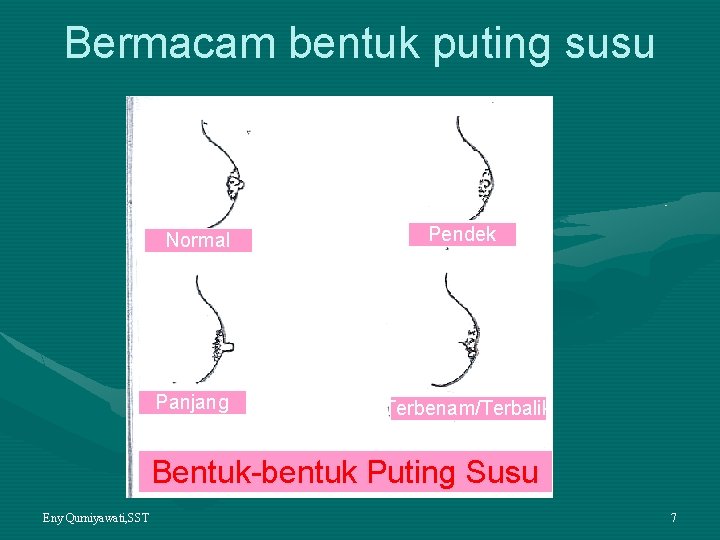 Bermacam bentuk puting susu Normal Panjang Pendek Terbenam/Terbalik Bentuk-bentuk Puting Susu Eny Qurniyawati, SST