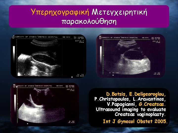 Υπερηχογραφική Μετεγχειρητική παρακολούθηση D. Botsis, E. Deligeoroglou, P. Christopoulos, L. Aravantinos, V. Papagianni, G.