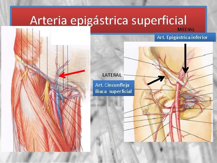 Arteria epigástrica superficial MEDIAL Art. Epigástrica inferior LATERAL Art. Cincunfleja ilíaca superficial 
