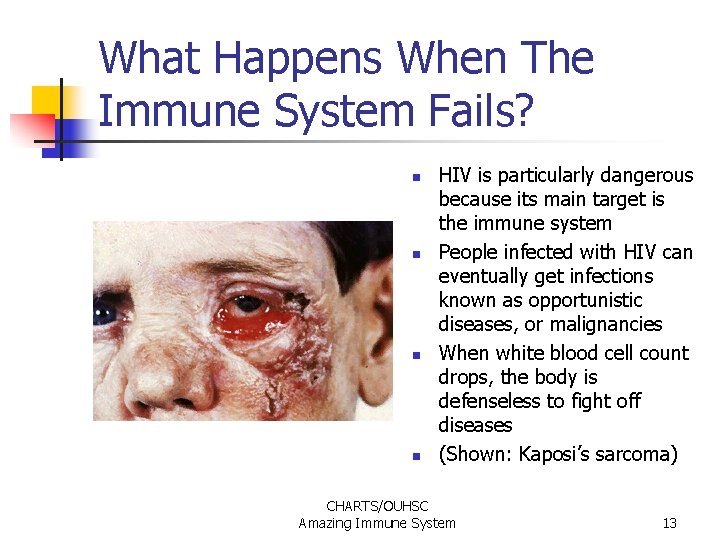 What Happens When The Immune System Fails? n n HIV is particularly dangerous because What Happens When The Immune System Fails? n n HIV is particularly dangerous because
