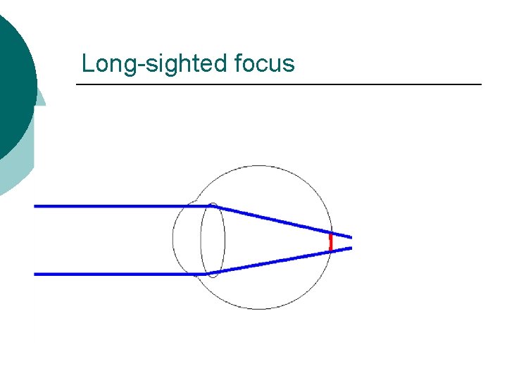 Long-sighted focus 