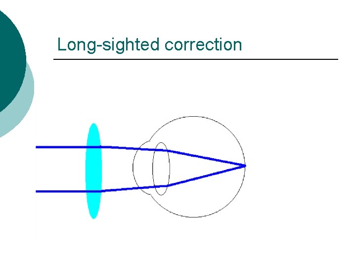 Long-sighted correction 