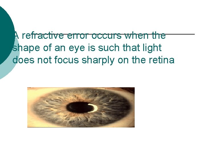 A refractive error occurs when the shape of an eye is such that light