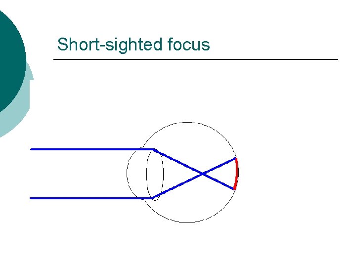 Short-sighted focus 