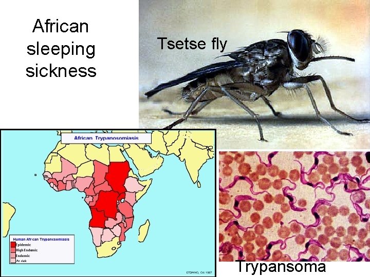 African sleeping sickness Tsetse fly Trypansoma 