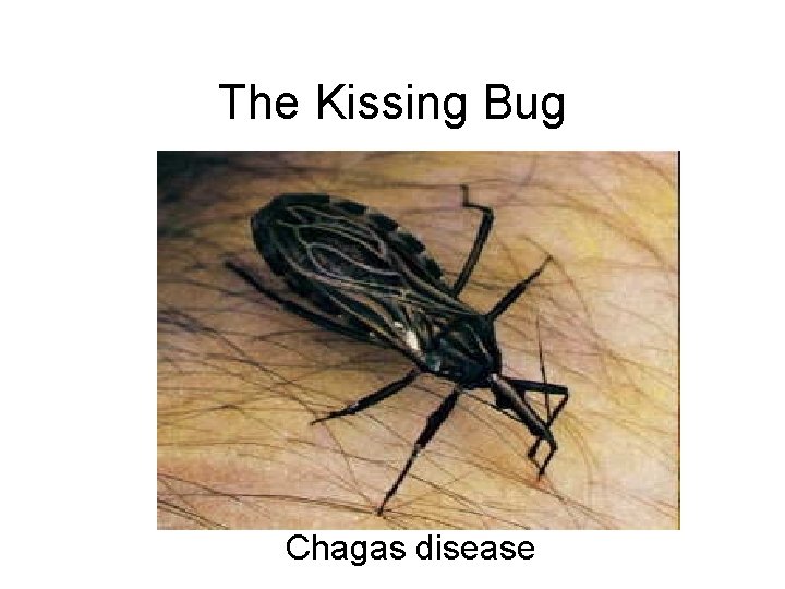 The Kissing Bug Chagas disease 