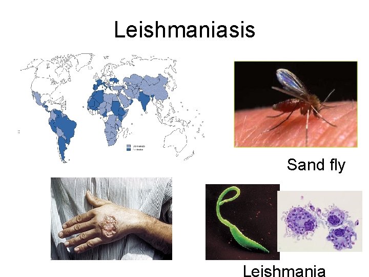 Leishmaniasis Sand fly Leishmania 