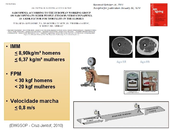  • IMM < 8, 90 kg/m² homens < 6, 37 kg/m² mulheres •