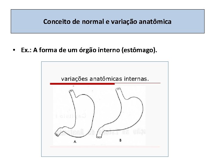 Conceito de normal e variação anatômica • Ex. : A forma de um órgão