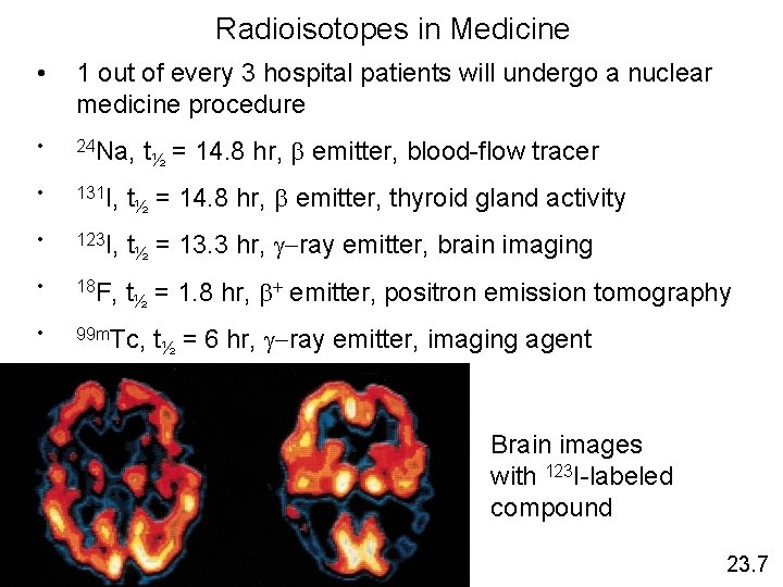 Radioisotopes in Medicine • 1 out of every 3 hospital patients will undergo a