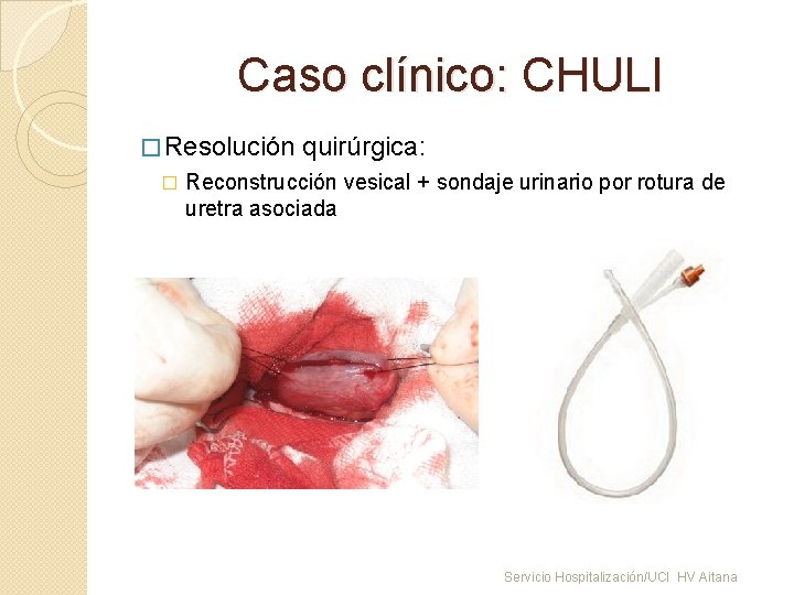 Caso clínico: CHULI � Resolución quirúrgica: � Reconstrucción vesical + sondaje urinario por rotura