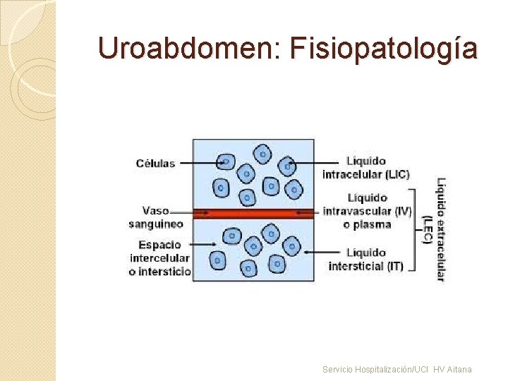 Uroabdomen: Fisiopatología Servicio Hospitalización/UCI HV Aitana 