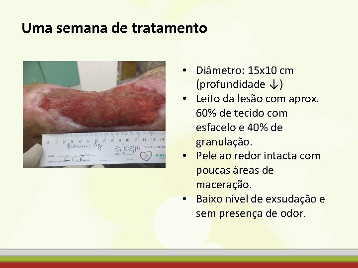 Uma semana de tratamento • Diâmetro: 15 x 10 cm (profundidade ↓) • Leito