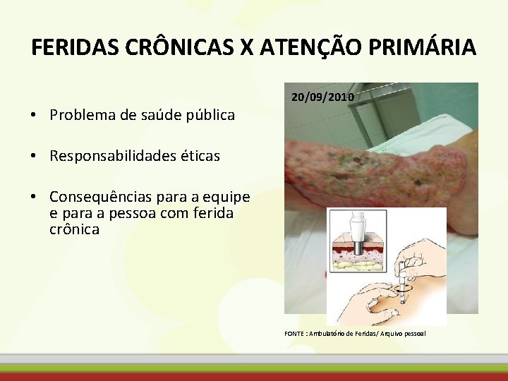 FERIDAS CRÔNICAS X ATENÇÃO PRIMÁRIA • Problema de saúde pública 20/09/2010 • Responsabilidades éticas