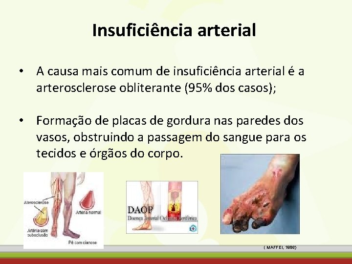 Insuficiência arterial • A causa mais comum de insuficiência arterial é a arterosclerose obliterante