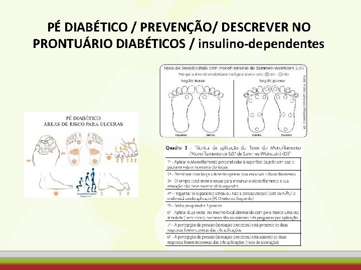 PÉ DIABÉTICO / PREVENÇÃO/ DESCREVER NO PRONTUÁRIO DIABÉTICOS / insulino-dependentes 