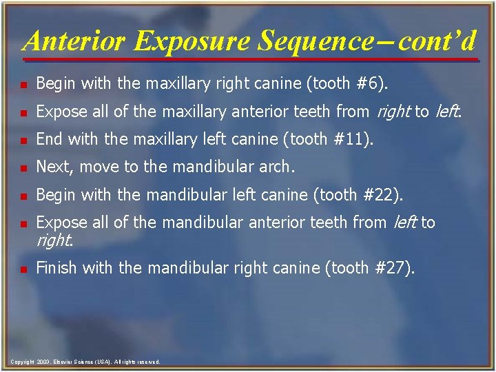 Anterior Exposure Sequence- cont’d n Begin with the maxillary right canine (tooth #6). n