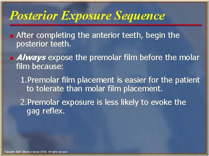 Posterior Exposure Sequence n n After completing the anterior teeth, begin the posterior teeth.
