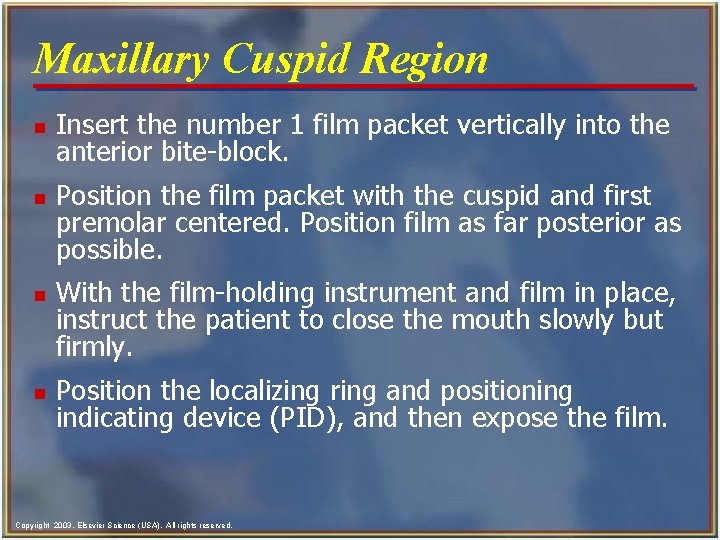 Maxillary Cuspid Region n n Insert the number 1 film packet vertically into the