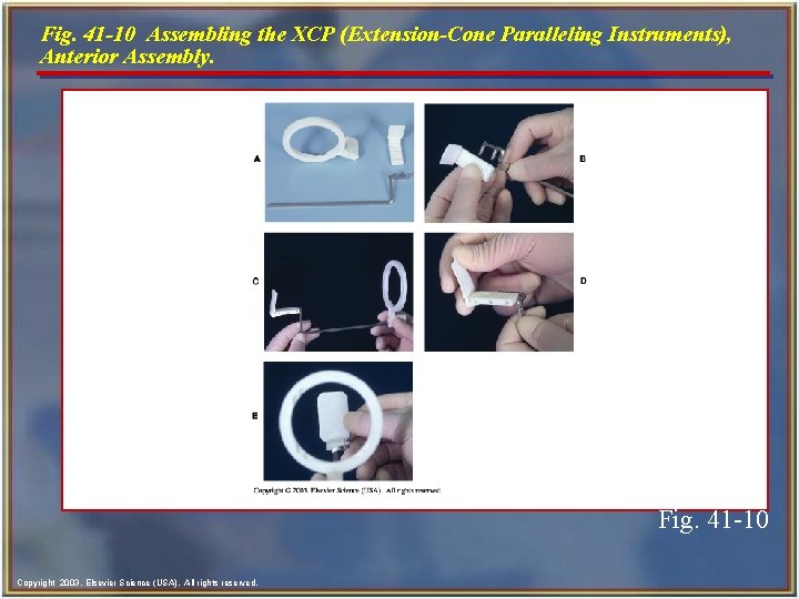 Fig. 41 -10 Assembling the XCP (Extension-Cone Paralleling Instruments), Anterior Assembly. Fig. 41 -10