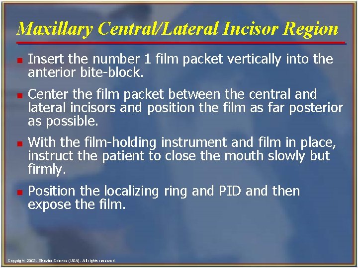 Maxillary Central/Lateral Incisor Region n n Insert the number 1 film packet vertically into