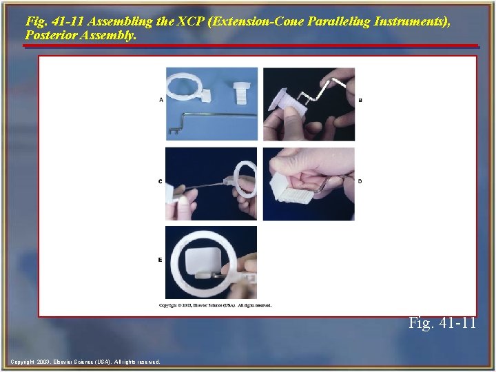 Fig. 41 -11 Assembling the XCP (Extension-Cone Paralleling Instruments), Posterior Assembly. Fig. 41 -11