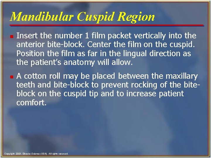 Mandibular Cuspid Region n n Insert the number 1 film packet vertically into the