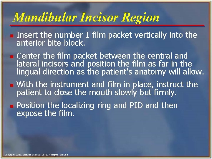 Mandibular Incisor Region n n Insert the number 1 film packet vertically into the