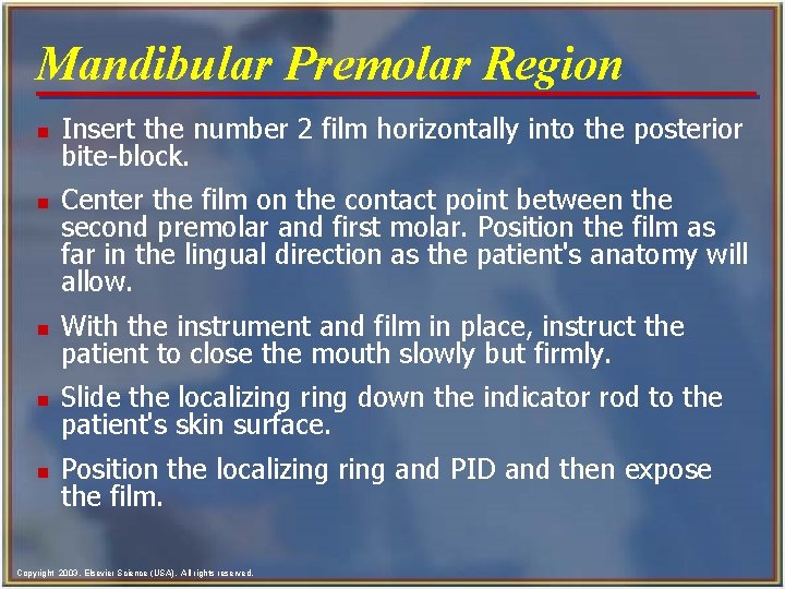 Mandibular Premolar Region n n Insert the number 2 film horizontally into the posterior