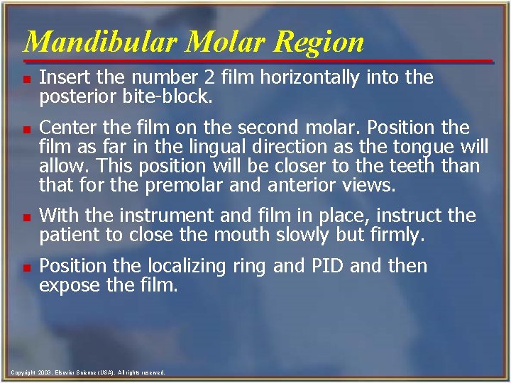 Mandibular Molar Region n n Insert the number 2 film horizontally into the posterior