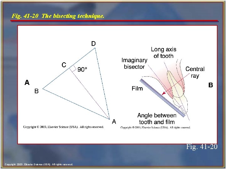 Fig. 41 -20 The bisecting technique. Fig. 41 -20 Copyright 2003, Elsevier Science (USA).