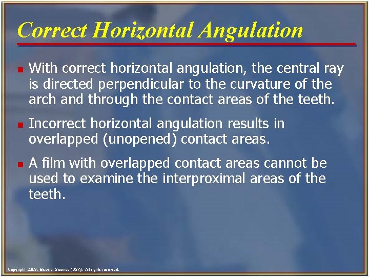 Correct Horizontal Angulation n With correct horizontal angulation, the central ray is directed perpendicular