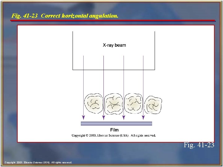 Fig. 41 -23 Correct horizontal angulation. Fig. 41 -23 Copyright 2003, Elsevier Science (USA).
