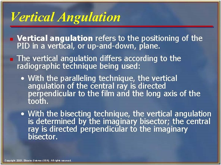 Vertical Angulation n Vertical angulation refers to the positioning of the PID in a