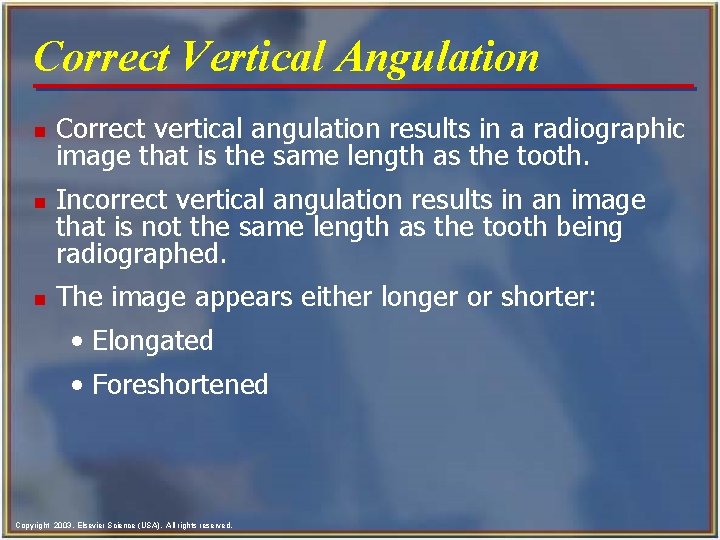 Correct Vertical Angulation n Correct vertical angulation results in a radiographic image that is