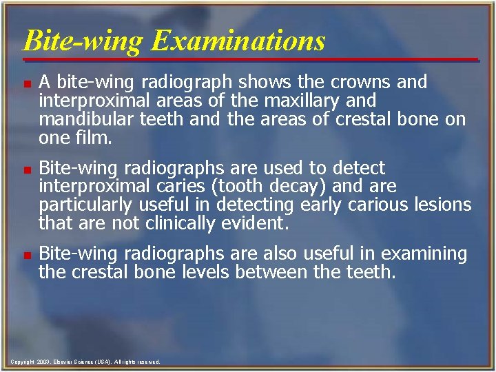 Bite-wing Examinations n n n A bite-wing radiograph shows the crowns and interproximal areas