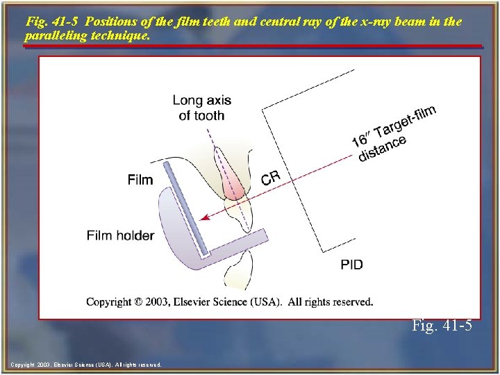 Fig. 41 -5 Positions of the film teeth and central ray of the x-ray