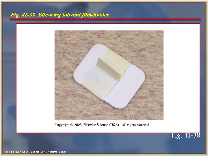 Fig. 41 -38 Bite-wing tab and film-holder. Fig. 41 -38 Copyright 2003, Elsevier Science