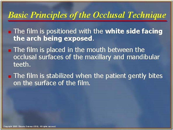 Basic Principles of the Occlusal Technique n n n The film is positioned with