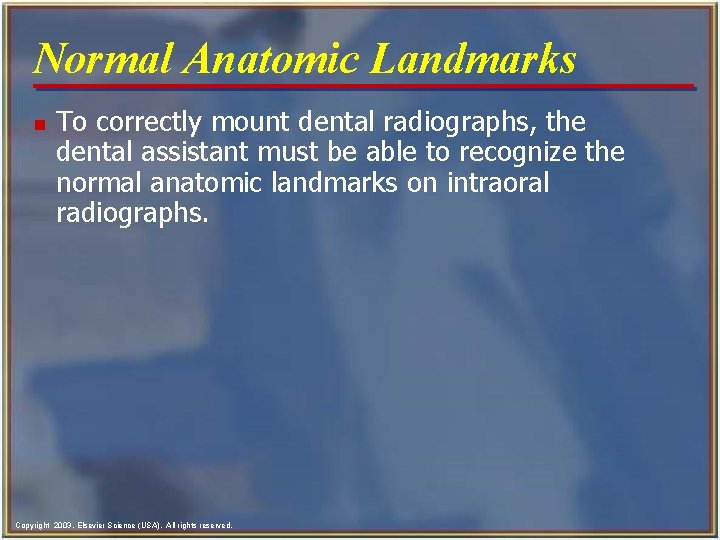 Normal Anatomic Landmarks n To correctly mount dental radiographs, the dental assistant must be