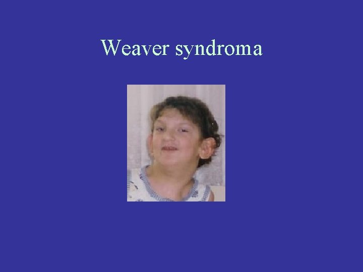 Weaver syndroma 