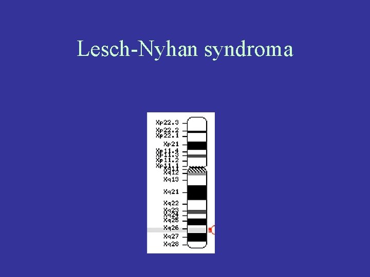 Lesch-Nyhan syndroma 