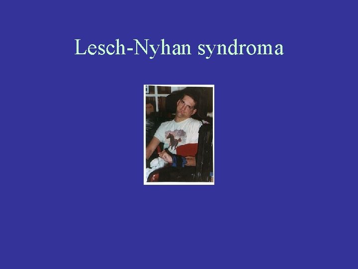 Lesch-Nyhan syndroma 