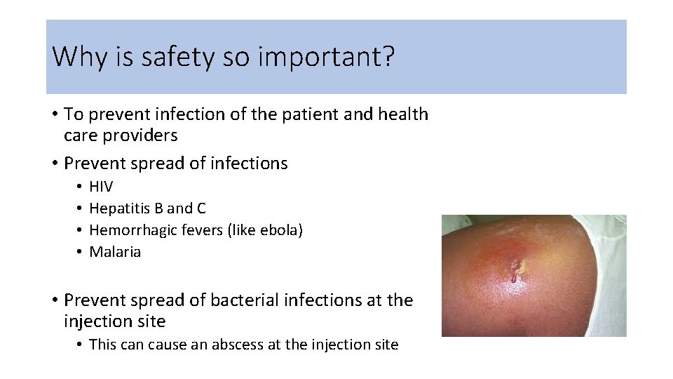 Why is safety so important? • To prevent infection of the patient and health
