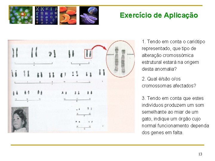 Exercício de Aplicação 1. Tendo em conta o cariótipo representado, que tipo de alteração