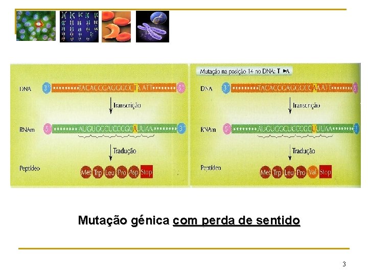 Mutação génica com perda de sentido 3 