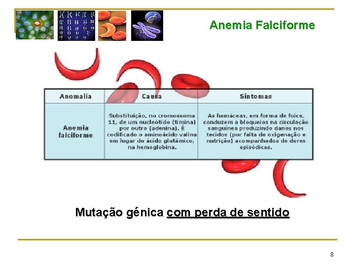 Anemia Falciforme Mutação génica com perda de sentido 8 