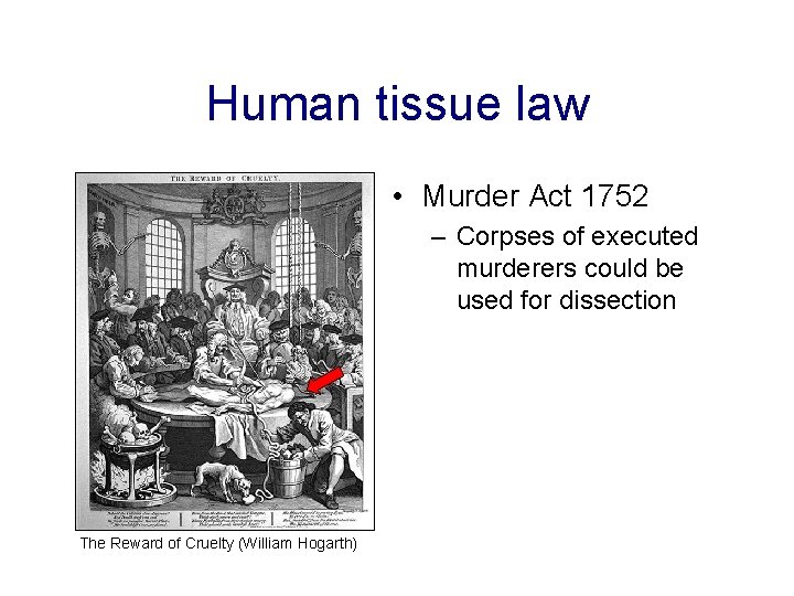 Human tissue law • Murder Act 1752 – Corpses of executed murderers could be