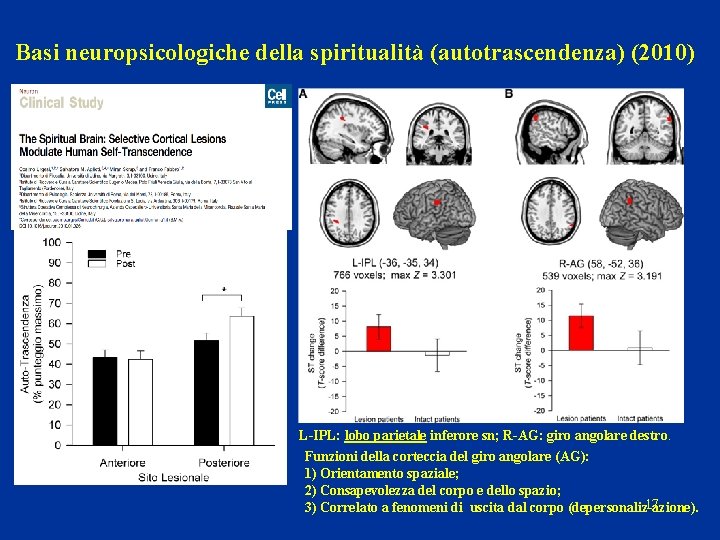 Basi neuropsicologiche della spiritualità (autotrascendenza) (2010) L-IPL: lobo parietale inferore sn; R-AG: giro angolare