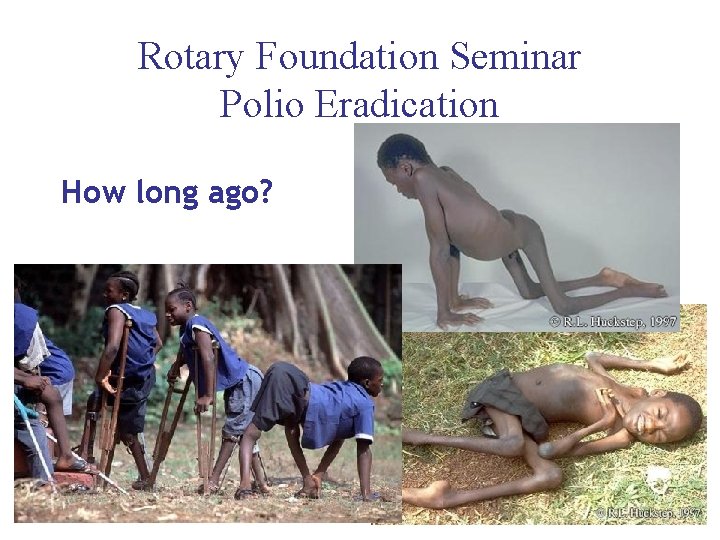 Rotary Foundation Seminar Polio Eradication How long ago? 